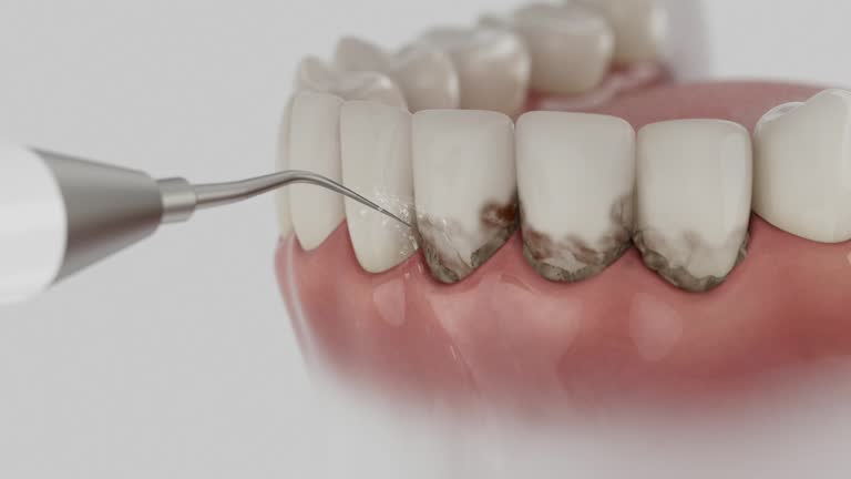 Trusted Teeth Cleaning And Checkup service in Oakhurst, CA - Dentist Open Now